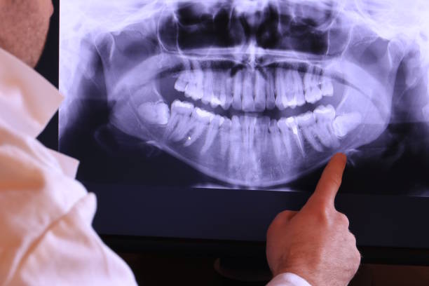 Best Orthodontic Emergency Dentist in Blountville, TN