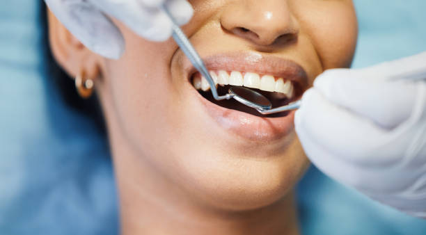 Best Emergency Dentist for Lost Fillings or Crowns in Blountville, TN